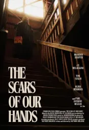 Шрамы на наших руках